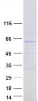 Human FBX33 / FBXO33 Protein (Recombinant Myc-DDK (Flag))