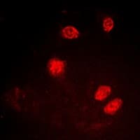 Polyclonal Rabbit anti-Human XRCC5 / Ku80 Antibody (C-Terminus, IHC, IF, WB)