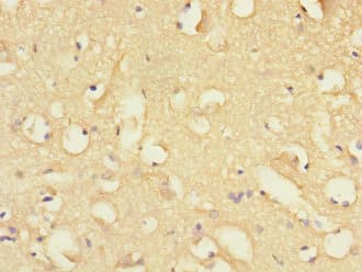 FBXO2 Antibody