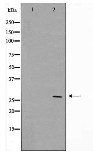 Polyclonal Rabbit anti-Human HOXD12 Antibody (WB)