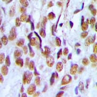 PHF19 Antibody