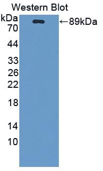 PLAT / TPA Antibody (aa39-562)
