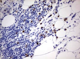 MKI67 / Ki67 Antibody (aa1160-1493, clone OTI16E9)