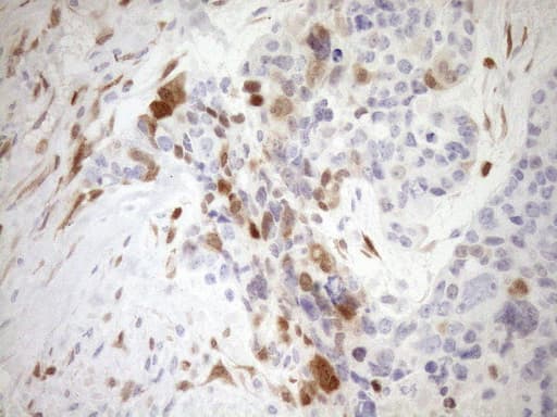 p16INK4a / CDKN2A Antibody (clone OTI3G3)