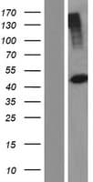 PHKG2 Protein (Over-Expression Lysate Myc-DDK (Flag))