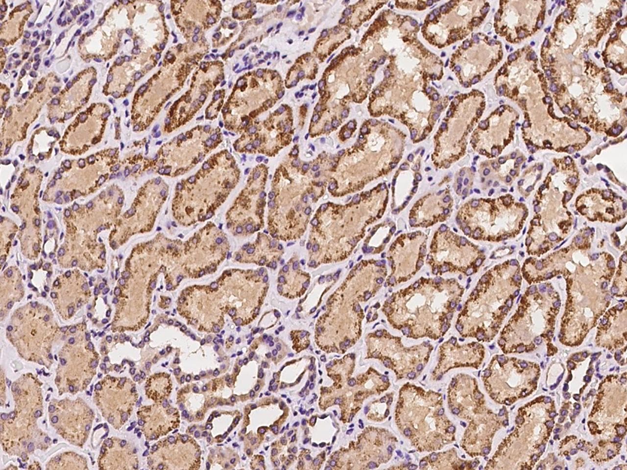 Polyclonal Rabbit anti-Human ACADSB Antibody (IHC, WB)
