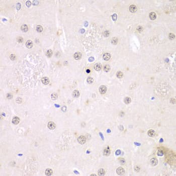 Polyclonal Rabbit anti-Human FMR1 / FMRP Antibody (IHC, IF, WB)