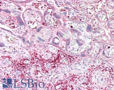 Polyclonal Rabbit anti-Human CD39 Antibody (aa241-486, IHC, WB)
