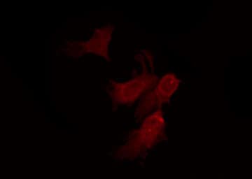 Polyclonal Rabbit anti-Human OR10D4P Antibody (IF, WB)