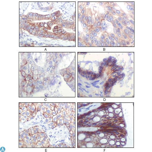 IGF1R / IGF1 Receptor Antibody