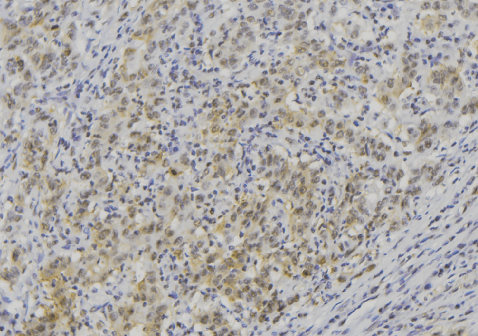 Polyclonal Rabbit anti-Human LAMC3 / Laminin Gamma 3 Antibody (IHC, WB)