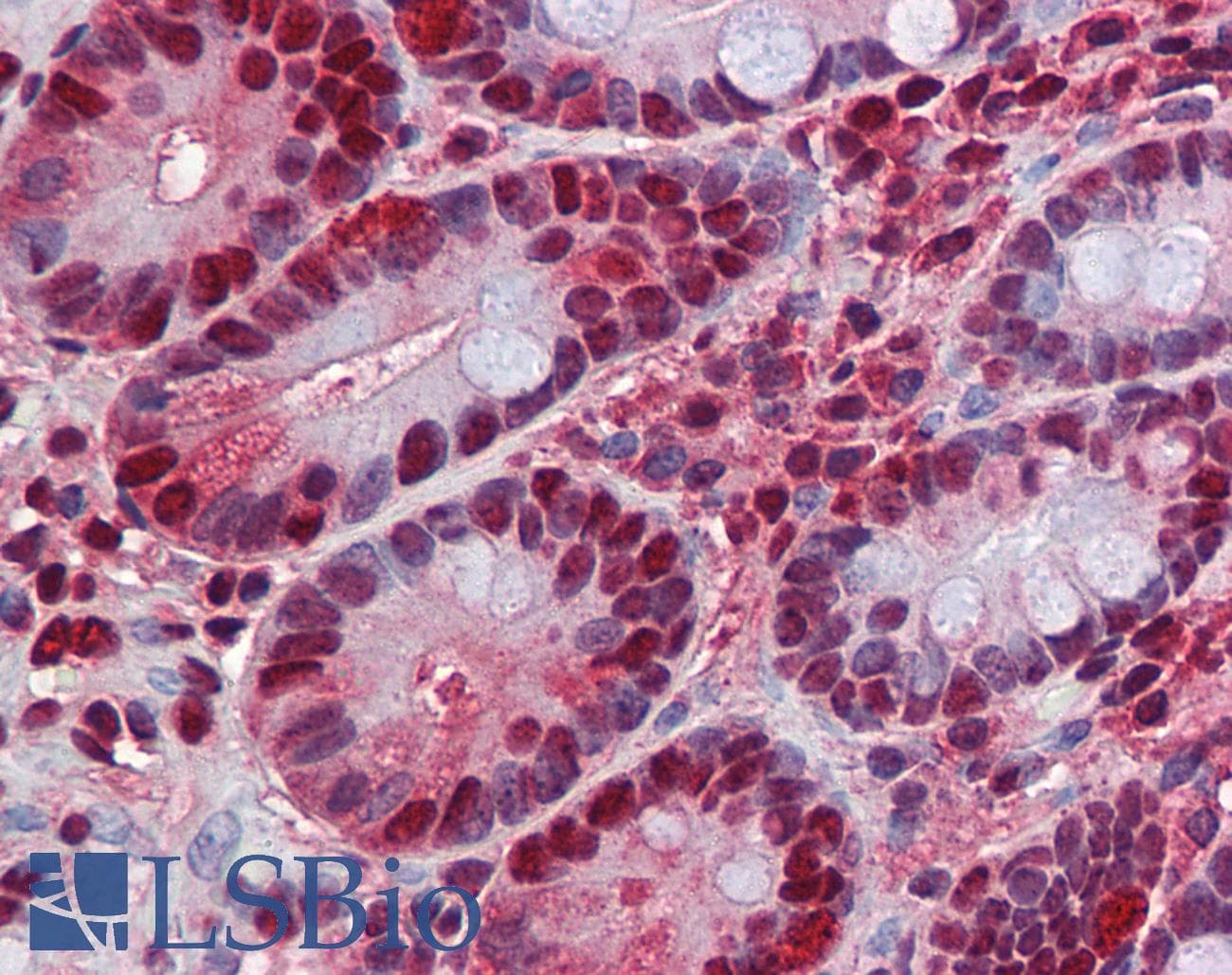IHC-plus™ HDAC1 Antibody (clone 5A11)