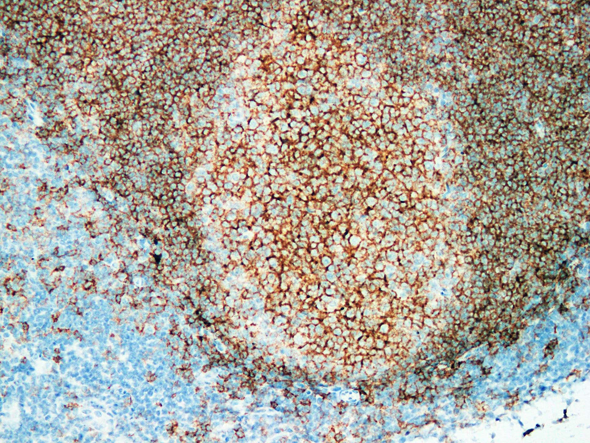 CD20 Antibody (clone ABT-CD20)