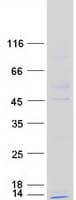 Human KFYI / NDUFC1 Protein (Recombinant Myc-DDK (Flag))