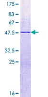 Human RPL21 / Ribosomal Protein L21 (Recombinant GST)