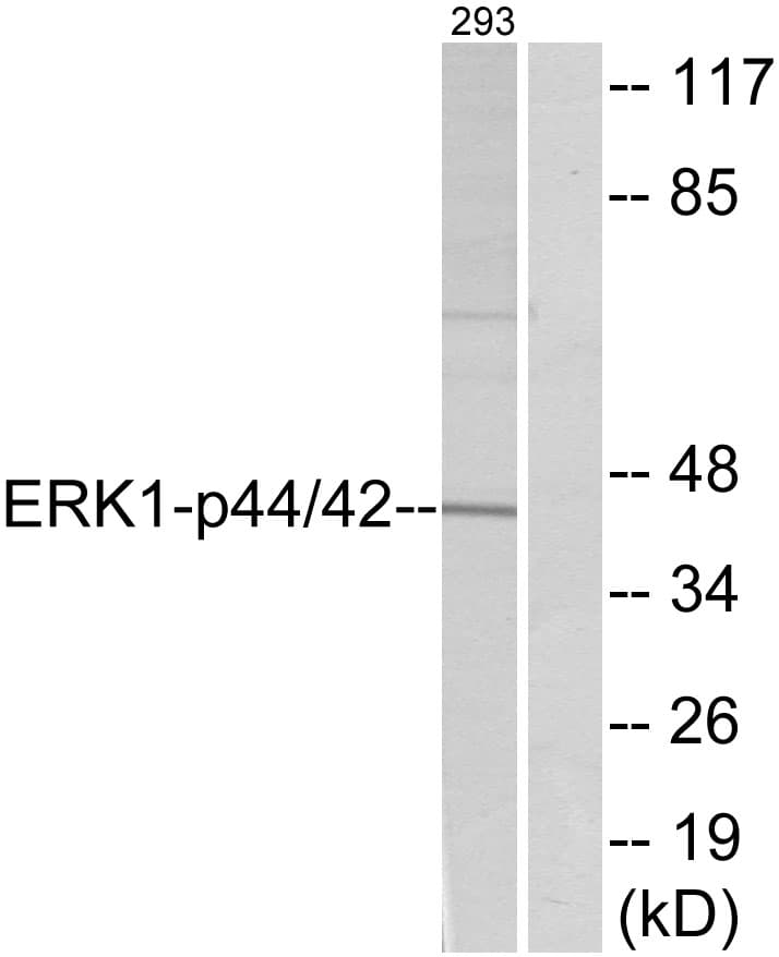 ERK1 + ERK2 Antibody (aa169-218)