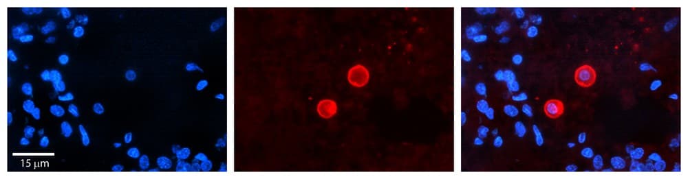 Polyclonal Rabbit anti-Human CES2 / Esterase Antibody (C-Terminus, IHC, IF, WB)