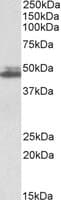 IHC-plus™ SH3GL1 / EEN Antibody (aa261-272)