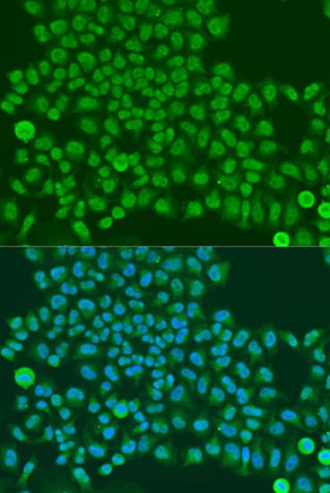 TDP-43 / TARDBP Antibody