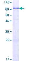 Human ABHD16A / BAT5 Protein (Recombinant GST)