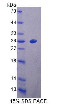 Human DPYSL4 / CRMP3 Protein (Recombinant His-T7, N-terminus)