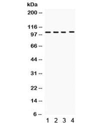 HDAC7 Antibody