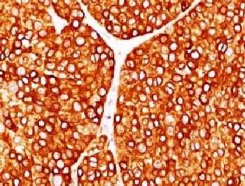Tyrosinase Antibody (clone TRSN1-1)