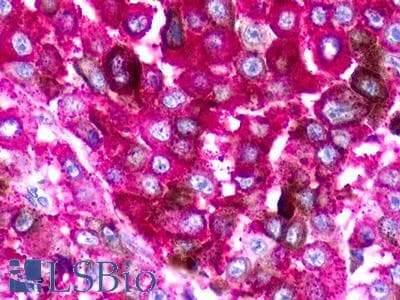 PathPlus™ Polyclonal Rabbit anti-Human NMUR1 Antibody (Cytoplasmic Domain, IHC)