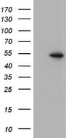 PPARA / PPAR Alpha Antibody (aa145-420, clone OTI2D10)