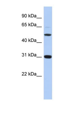 Polyclonal Rabbit anti-Human PI16 Antibody (C-Terminus, WB)