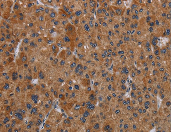 Polyclonal Rabbit anti-Human OMG / OMGP Antibody (IHC)