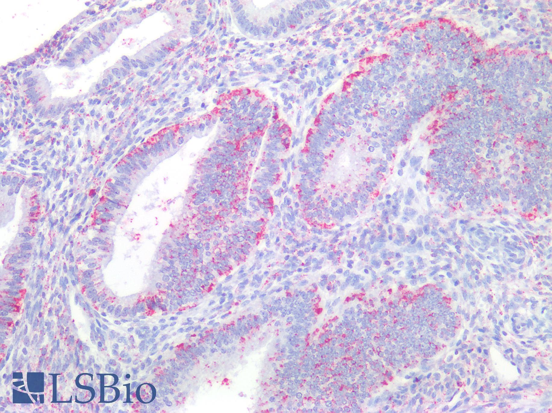 IHC-plus™ Polyclonal Rabbit anti-Human LPAR4 / GPR23 Antibody (C-Terminus, IHC)