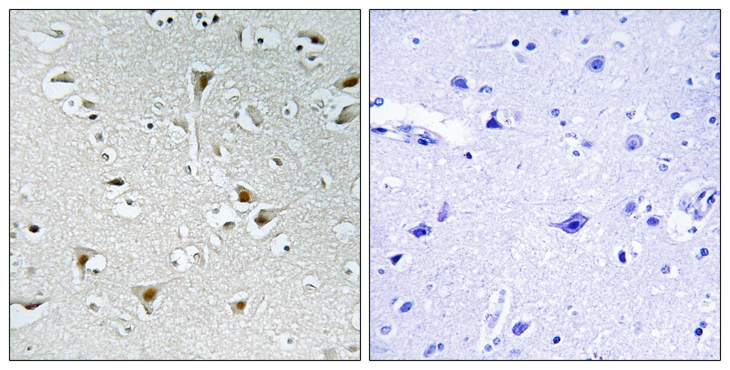 FAM111B Antibody