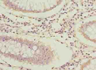 Polyclonal Rabbit anti-Human ARPIN / C15orf38 Antibody (IHC, WB)