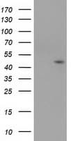 Monoclonal Mouse anti-Human SERPINB4 / SCCA1+2 Antibody (clone OTI2H8, WB)