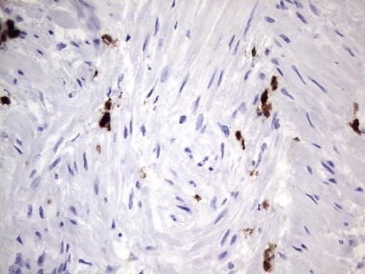 S100A9 / MRP14 Antibody (clone OTI3C12)