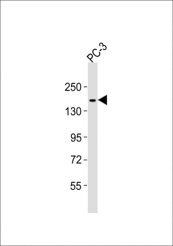ITGA3 / CD49c Antibody (aa875-909)