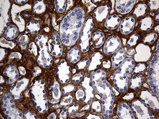 TGFBI Antibody (aa405-683, clone OTI9A11)