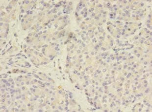Polyclonal Rabbit anti-Human TSAP6 / STEAP3 Antibody (IHC, WB)