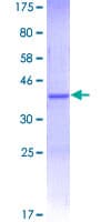 Human MYO9B Protein (Recombinant GST, N-terminus)