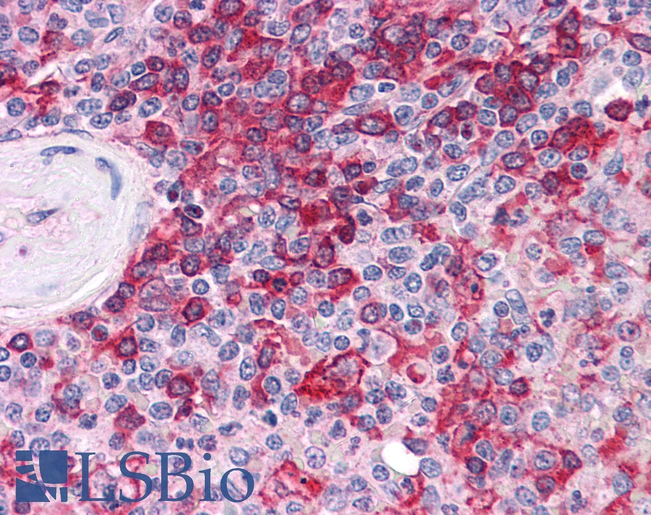 IHC-plus™ MPP5 Antibody