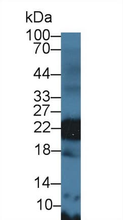 GP9 / CD42a Antibody (aa1-161)