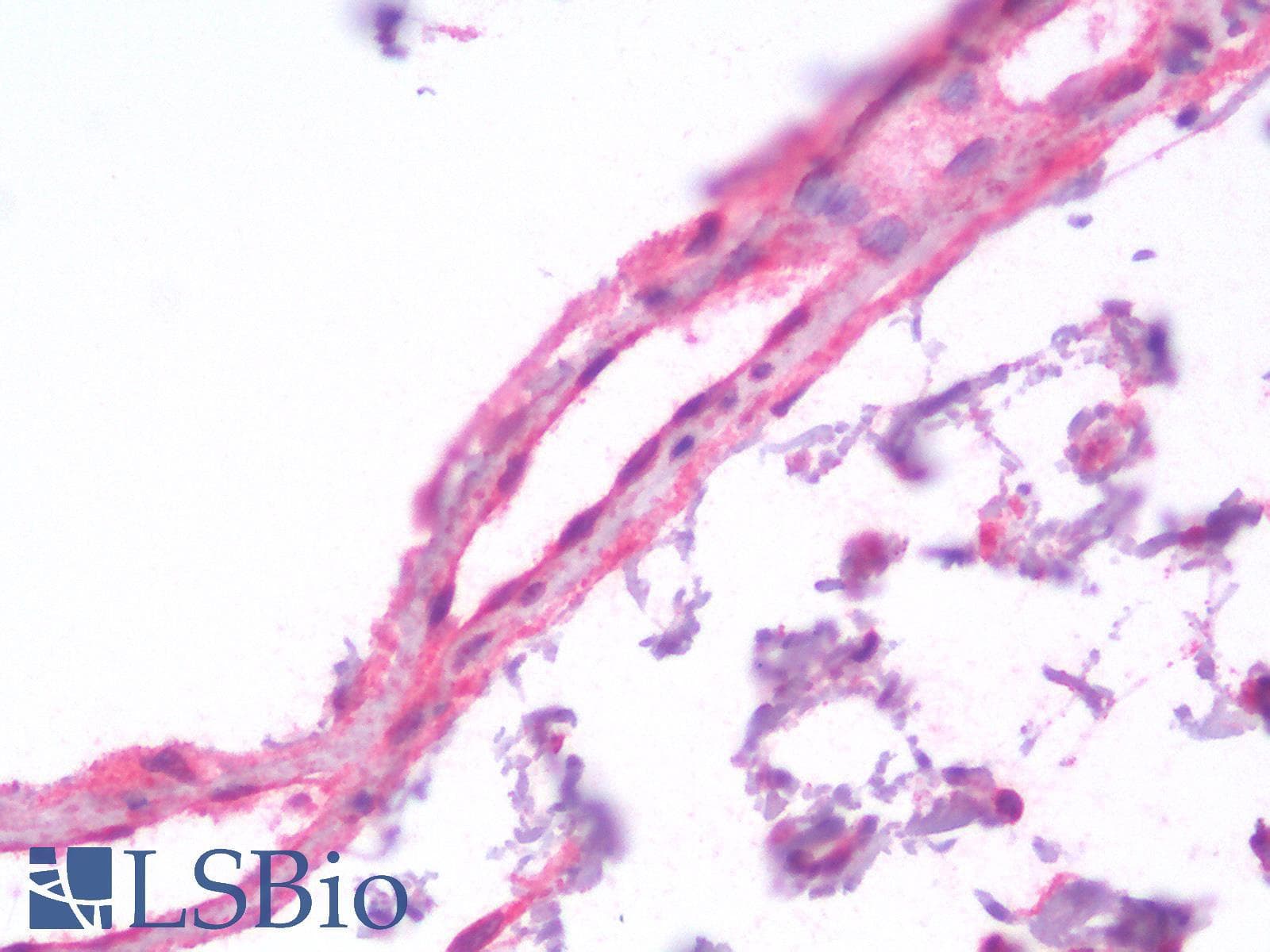 IHC-plus™ Polyclonal Rabbit anti-Human ERG Antibody (IHC)
