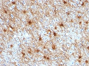 GFAP Antibody (clone ASTRO/789, Ready-to-Use)