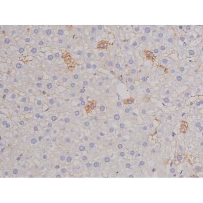FAK / Focal Adhesion Kinase Antibody (phospho-Tyr576)
