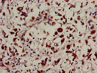 Polyclonal Rabbit anti-Human USP22 Antibody (IHC, IF)