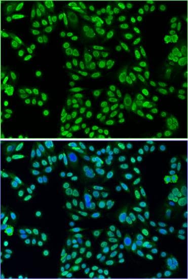 Polyclonal Rabbit anti-Human TP53 / p53 Antibody (IF, WB)