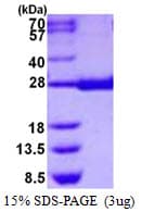 Human HPGDS Protein (Recombinant His)
