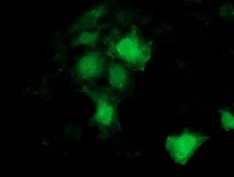 BCAR1 / p130Cas Antibody (clone OTI3A5)