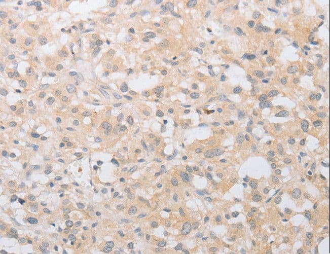 Polyclonal Rabbit anti-Human ATG9A Antibody (IHC, WB)
